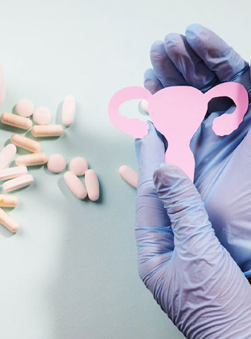 How to Treat PCOS Naturally