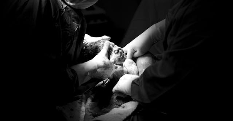 Common Neonatal Screening Tests Every Newborn Should Undergo