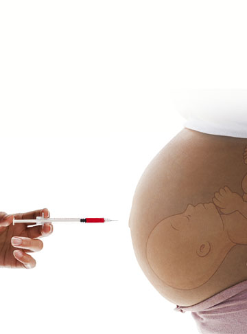 Advantages and Disadvantages of IVF