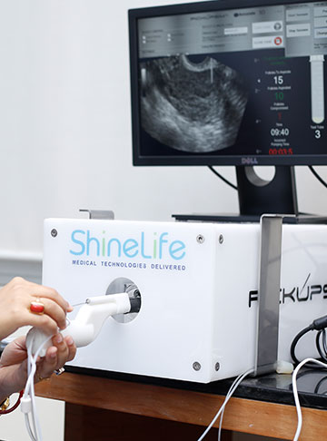 When to Start IVF After Hysteroscopy: Importance & Factors