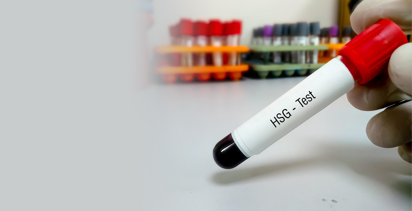 HSG Test Hysterosalpingogram X Ray for Female Infertility Indira IVF