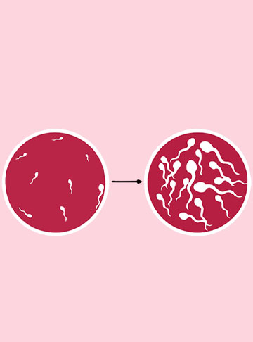Oligospermia (Low Sperm Count)