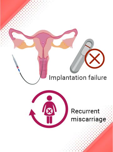 Recurrent Implantation Failure