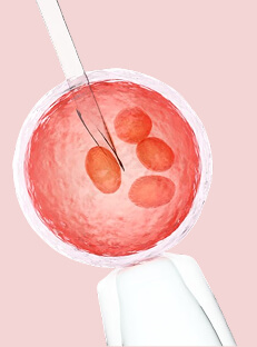 Test Tube Baby Cost in Hindi