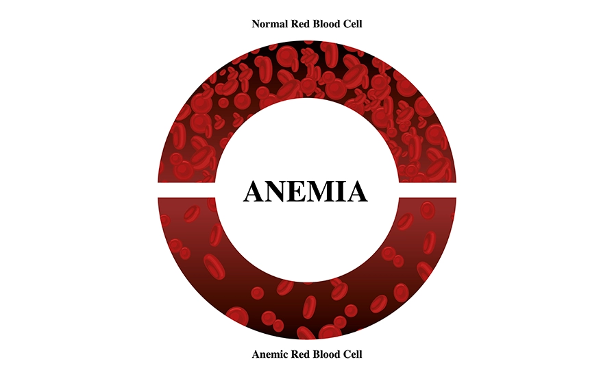 Anaemia