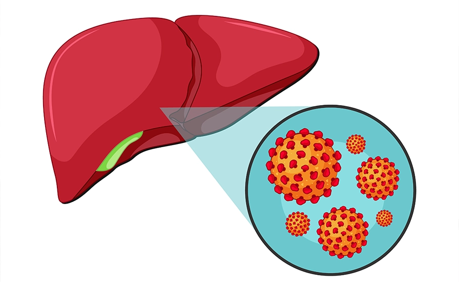 Hepatitis