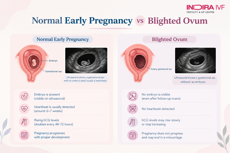 Normal Early Pregnancy vs Blighted Ovum