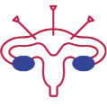 Indira IVF Laparoscopy