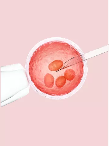 Indira IVF Banner