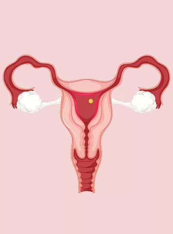 Indira IVF Banner