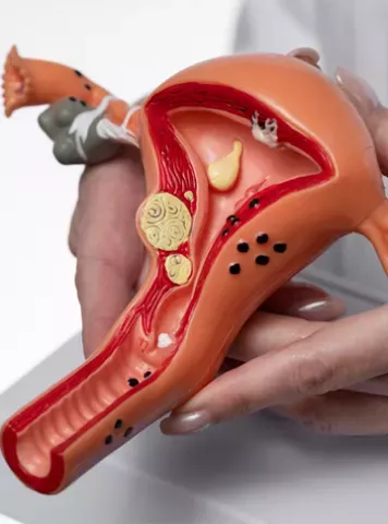 Implantation Bleeding vs. Menstrual Cycle: Key Differences & When to Test