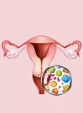 Vaginal Infections Uncovered: What Every Woman Should Know