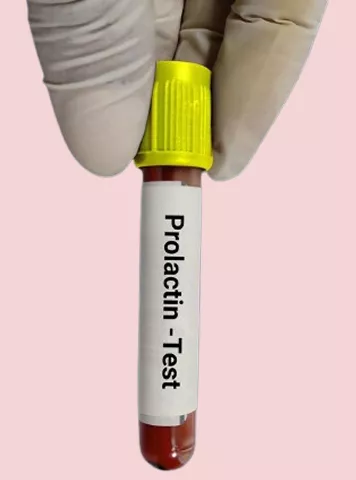 How To Reduce Prolactin Level Safely And Effectively?