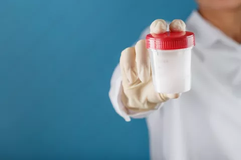 स्पर्म क्वांटिटी और क्वालिटी कैसे ठीक करें (Sperm Kaise Badhaye)