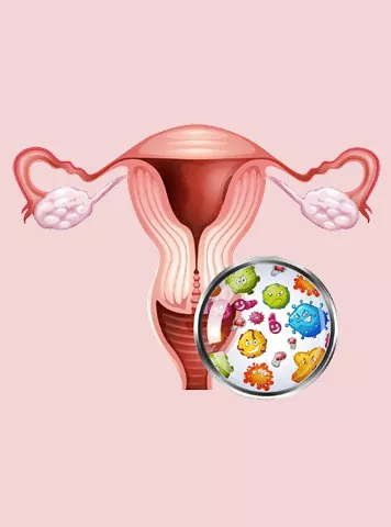 Vaginitis Symptoms by Type: Bacterial, Fungal and Parasitic Infections