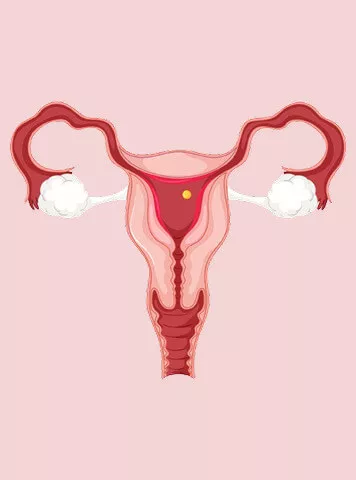 गर्भाशय क्या है और रिपोर्ट में इसका क्या मतलब है? (Uterus Meaning in Hindi)
