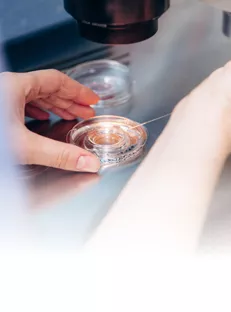 लेज़र हैचिंग से IVF सक्सेस रेट पर असर (Laser hatching in ivf in hindi)