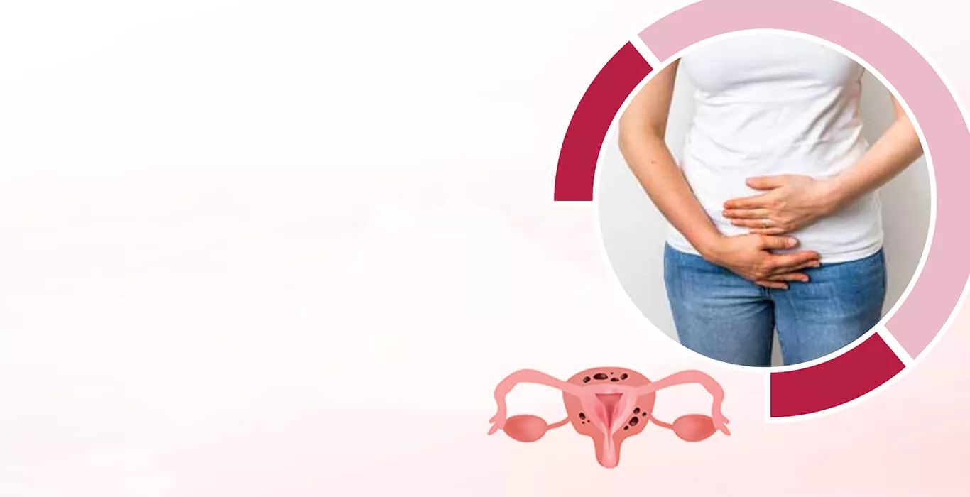 Adenomyosis