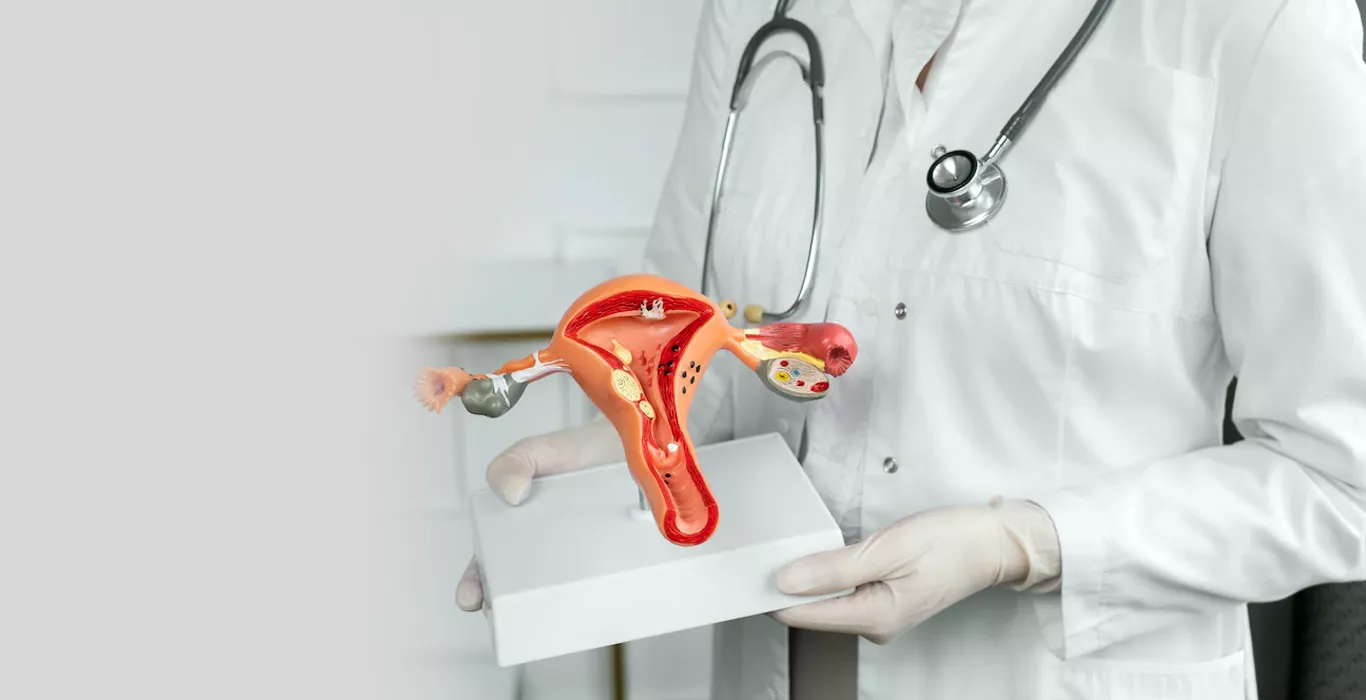 What is the Difference Between Adenomyosis And Fibroids?