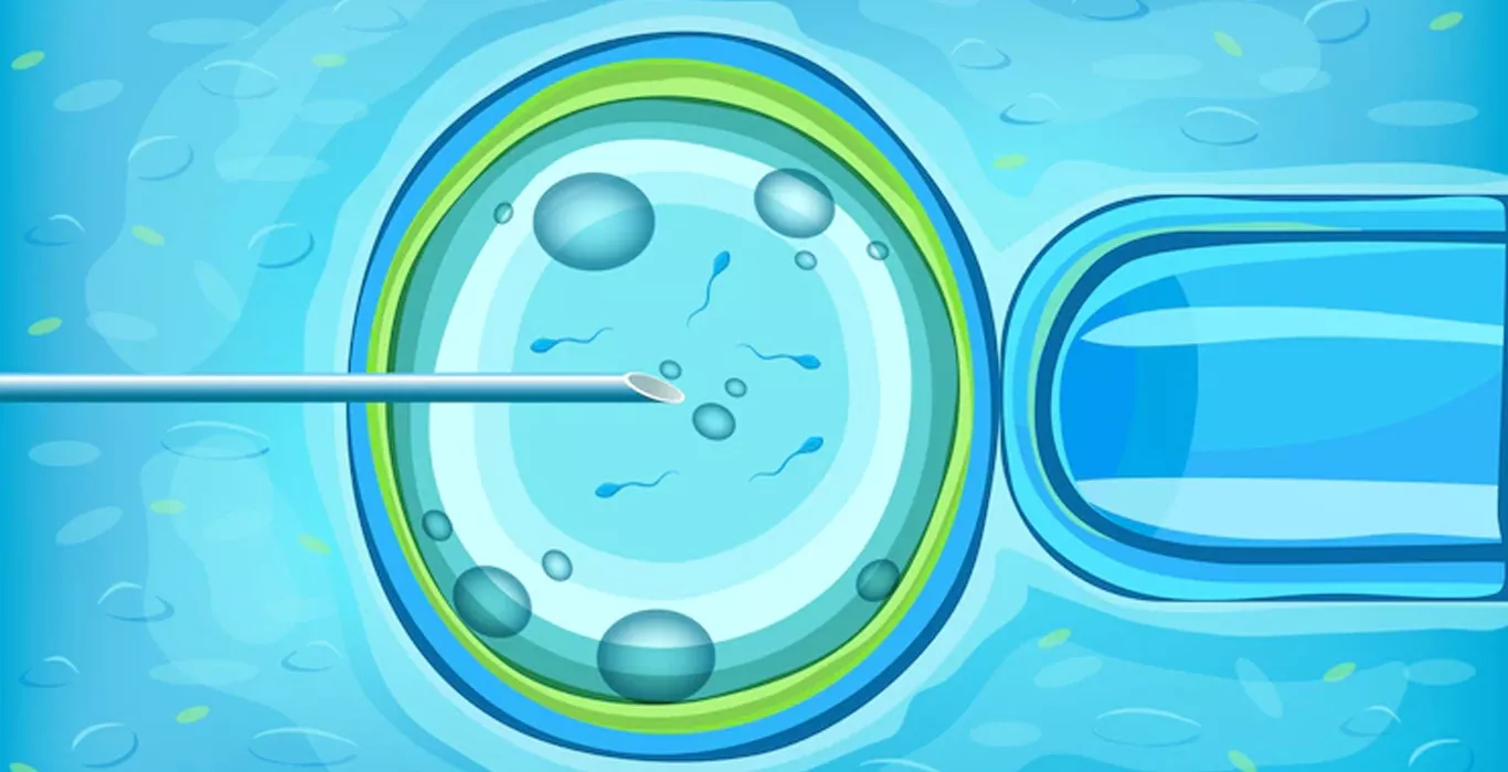 Artificial Insemination Benefits, Risks, Techniques, Success rates