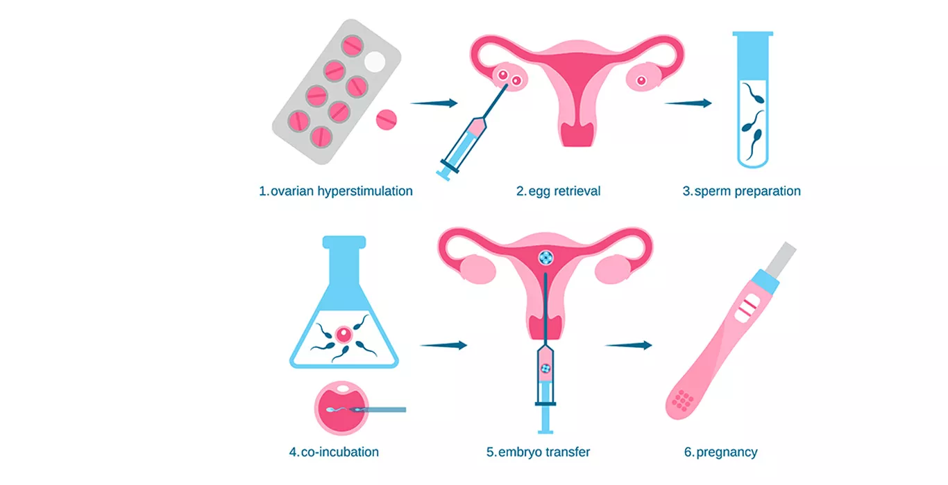 Test Tube Baby Process & Cost