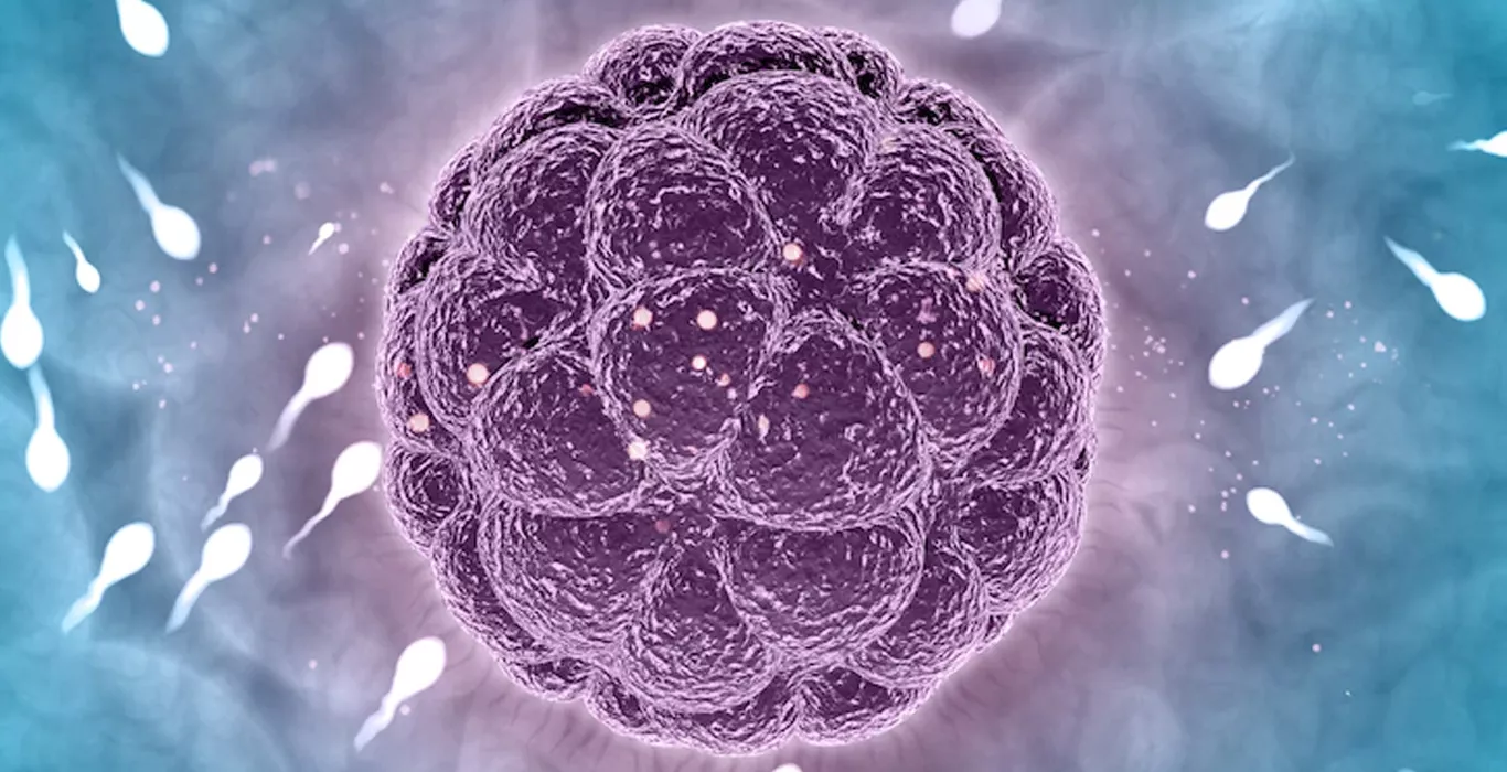 IMSI with IVF