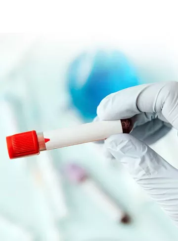 HCG Levels – 10 Things you need to know