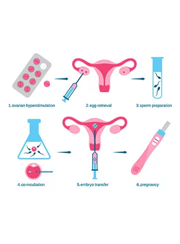 Test Tube Baby Process & Cost