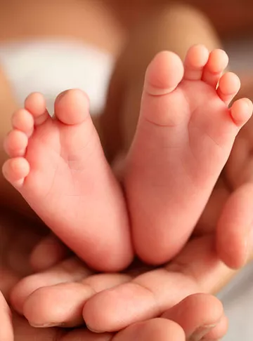 Are Birth Defects More Common With IVF?
