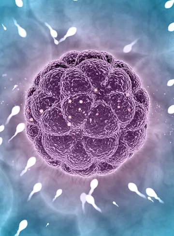 IMSI with IVF