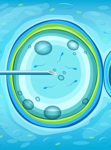 Artificial Insemination Benefits, Risks, Techniques, Success rates