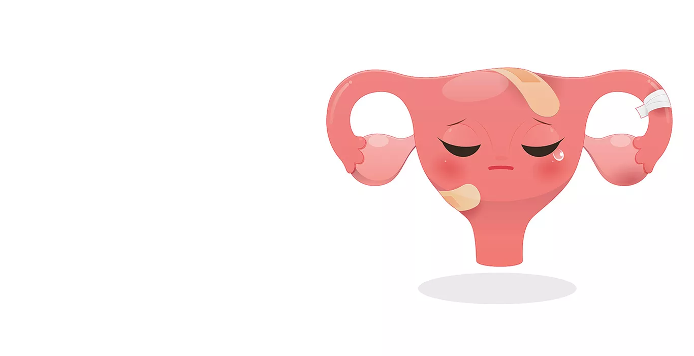 Premature ovarian failure