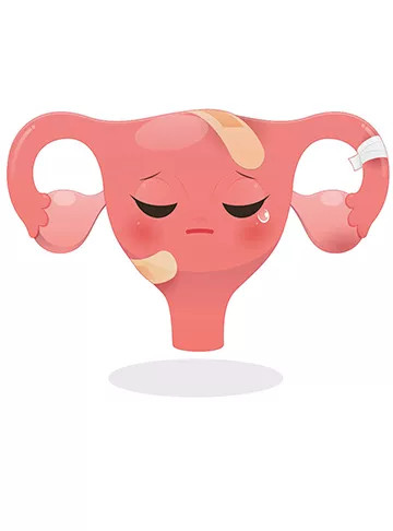 Premature ovarian failure