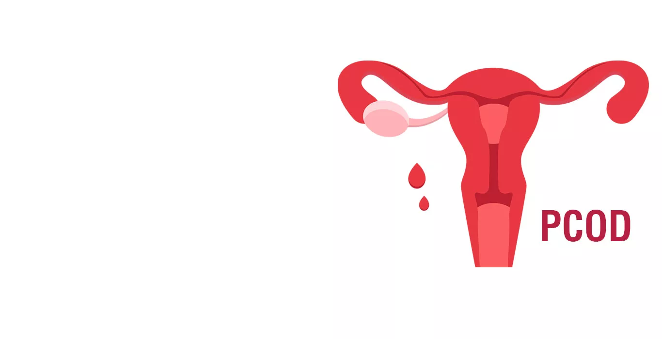 Polycystic Ovarian Disease (PCOD)