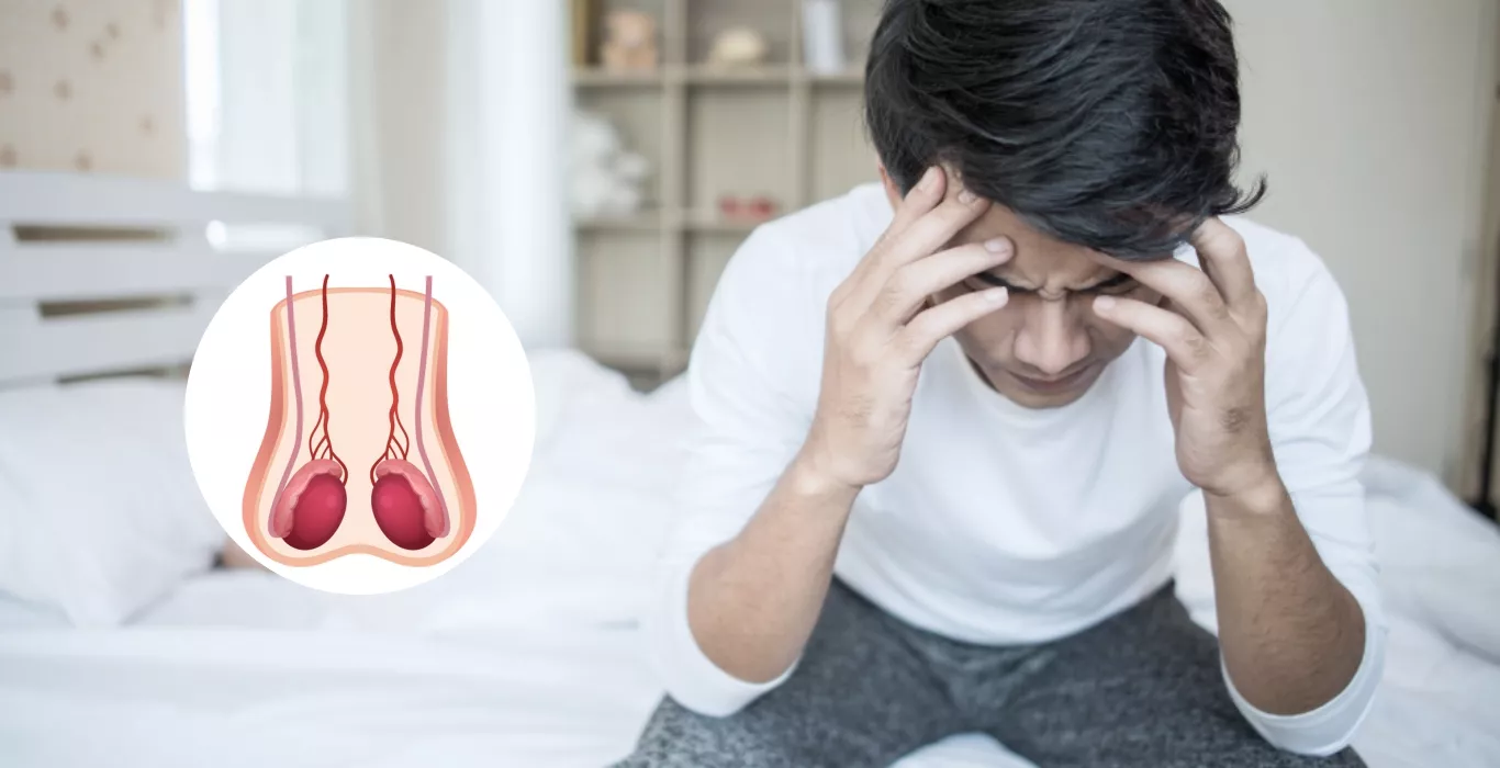 पुरूष निःसंतानता का एक कारण वेरिकोसिल आधुनिक तकनीकों से संभव है पिता बनना