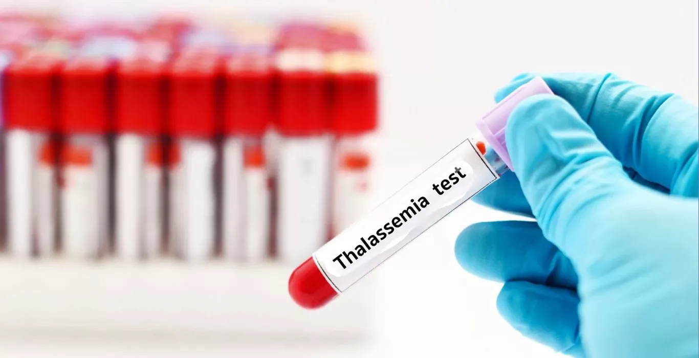 Thalassemia & Fertility | Meaning, Symptoms, Causes, Tests & Treatments  