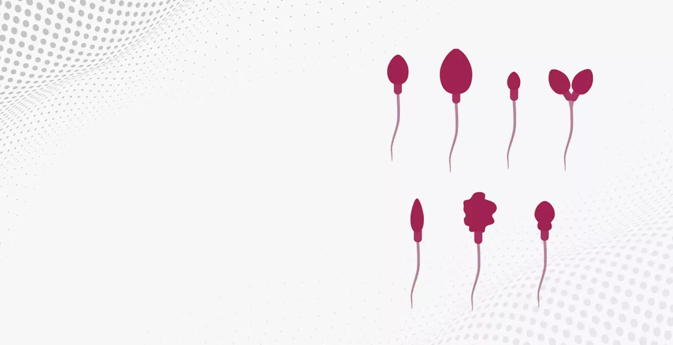 Teratozoospermia (Abnormal Sperm Morphology)