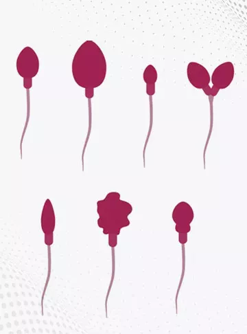 Teratozoospermia (Abnormal Sperm Morphology)