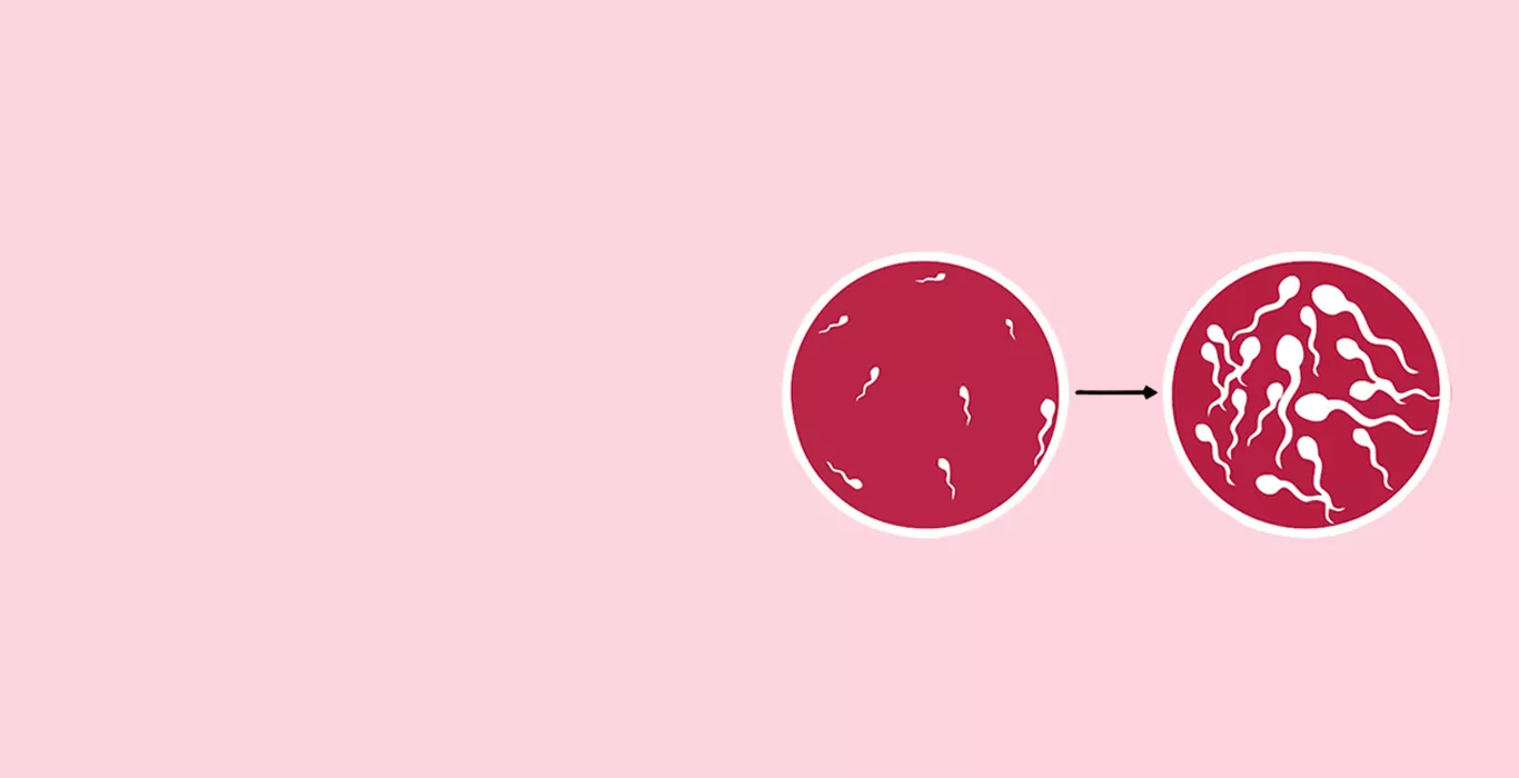 Oligospermia (Low Sperm Count)