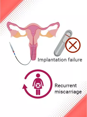 Recurrent Implantation Failure (RIF)
