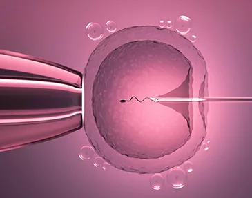 Treatments Offered <a href='/infertility-treatment/intracytoplasmic-sperm-injection-icsi-treatment'>Intracytoplasmic Sperm Injection (ICSI)</a>